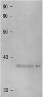 63-154_Fig1