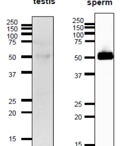 74-200-fig1