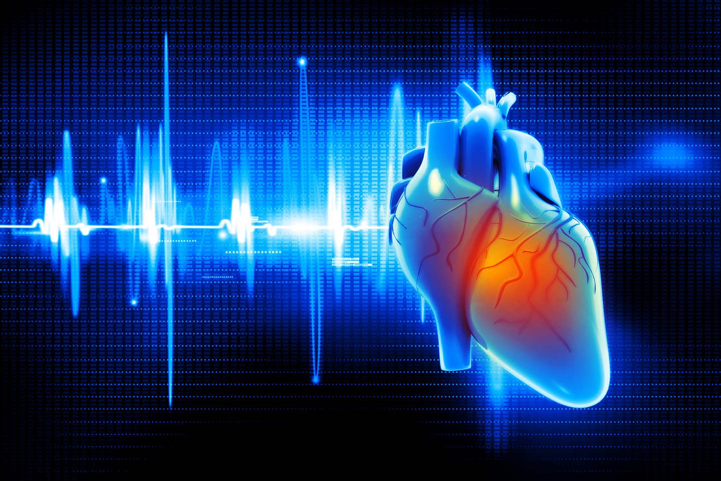 Cardiovascular Research