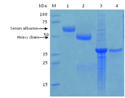 western electrophoresis